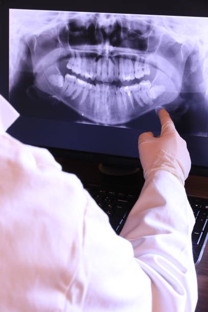 Best Broken or Chipped Tooth Repair in Farngton Hills, MI